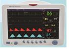 心电监护仪：为医生提供及时准确的心脏健康信息